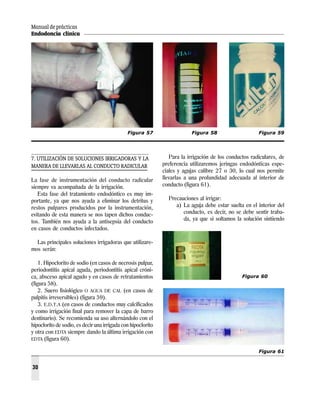 Manual de prácticas
Endodoncia clínica
30
7. UTILIZACIÓN DE SOLUCIONES IRRIGADORAS Y LA
MANERA DE LLEVARLAS AL CONDUCTO RADICULAR
La fase de instrumentación del conducto radicular
siempre va acompañada de la irrigación.
Esta fase del tratamiento endodóntico es muy im-
portante, ya que nos ayuda a eliminar los detritus y
restos pulpares producidos por la instrumentación,
evitando de esta manera se nos tapen dichos conduc-
tos. También nos ayuda a la antisepsia del conducto
en casos de conductos infectados.
Las principales soluciones irrigadoras que utilizare-
mos serán:
1. Hipoclorito de sodio (en casos de necrosis pulpar,
periodontitis apical aguda, periodontitis apical cróni-
ca, absceso apical agudo y en casos de retratamientos
(figura 58).
2. Suero fisiológico O AGUA DE CAL (en casos de
pulpitis irreversibles) (figura 59).
3. E.D.T.A (en casos de conductos muy calcificados
y como irrigación final para remover la capa de barro
dentinario). Se recomienda su uso alternándolo con el
hipoclorito de sodio, es decir una irrigada con hipoclorito
y otra con EDTA siempre dando la última irrigación con
EDTA (figura 60).
Para la irrigación de los conductos radiculares, de
preferencia utilizaremos jeringas endodónticas espe-
ciales y agujas calibre 27 o 30, lo cual nos permite
llevarlas a una profundidad adecuada al interior de
conducto (figura 61).
Precauciones al irrigar:
a) La aguja debe estar suelta en el interior del
conducto, es decir, no se debe sentir traba-
da, ya que si soltamos la solución sintiendo
Figura 57 Figura 58 Figura 59
Figura 60
Figura 61
 