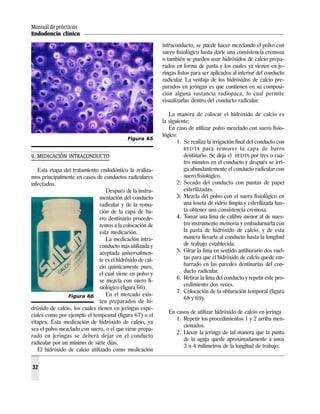 Manual de prácticas
Endodoncia clínica
32
9. MEDICACIÓN INTRACONDUCTO
Esta etapa del tratamiento endodóntico la realiza-
mos principalmente en casos de conductos radiculares
infectados.
Después de la instru-
mentación del conducto
radicular y de la remo-
ción de la capa de ba-
rro dentinario procede-
remos a la colocación de
esta medicación.
La medicación intra-
conducto más utilizada y
aceptada universalmen-
te es el hidróxido de cal-
cio químicamente puro,
el cual viene en polvo y
se mezcla con suero fi-
siológico (figura 66).
En el mercado exis-
ten preparados de hi-
dróxido de calcio, los cuales vienen en jeringas espe-
ciales como por ejemplo el tempcanal (figura 67) o el
vitapex. Esta medicación de hidróxido de calcio, ya
sea el polvo mezclado con suero, o el que viene prepa-
rado en jeringas se deberá dejar en el conducto
radicular por un mínimo de siete días.
El hidróxido de calcio utilizado como medicación
intraconducto, se puede hacer mezclando el polvo con
suero fisiológico hasta darle una consistencia cremosa
o también se pueden usar hidróxidos de calcio prepa-
rados en forma de pasta y los cuales ya vienen en je-
ringas listos para ser aplicados al interior del conducto
radicular. La ventaja de los hidróxidos de calcio pre-
parados en jeringas es que contienen en su composi-
ción alguna sustancia radiopaca, lo cual permite
visualizarlas dentro del conducto radicular.
La manera de colocar el hidróxido de calcio es
la siguiente:
En caso de utilizar polvo mezclado con suero fisio-
lógico:
1. Se realiza la irrigación final del conducto con
REDTA para remover la capa de barro
dentinario. Se deja el REDTA por tres o cua-
tro minutos en el conducto y después se irri-
ga abundantemente el conducto radicular con
suero fisiológico.
2. Secado del conducto con puntas de papel
esterilizadas.
3. Mezcla del polvo con el suero fisiológico en
una loseta de vidrio limpia y esterilizada has-
ta obtener una consistencia cremosa.
4. Tomar una lima de calibre menor al de nues-
tro instrumento memoria y embadurnarla con
la pasta de hidróxido de calcio, y de esta
manera llevarla al conducto hasta la longitud
de trabajo establecida.
5. Girar la lima en sentido antihorario dos vuel-
tas para que el hidróxido de calcio quede em-
barrado en las paredes dentinarias del con-
ducto radicular.
6. Retirar la lima del conducto y repetir este pro-
cedimiento dos veces.
7. Colocación de la obturación temporal (figura
68 y 69).
En casos de utilizar hidróxido de calcio en jeringa
1. Repetir los procedimientos 1 y 2 arriba men-
cionados.
2. Llevar la jeringa de tal manera que la punta
de la aguja quede aproximadamente a unos
3 o 4 milímetros de la longitud de trabajo.
Figura 65
Figura 66
 
