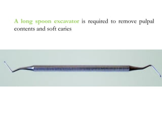 A long spoon excavator is required to remove pulpal
contents and soft caries
 
