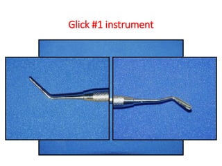Glick #1 instrument
 