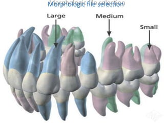 Morphologic file selection
 