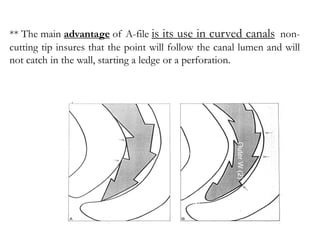 ** The main advantage of A-file is its use in curved canals non-
cutting tip insures that the point will follow the canal lumen and will
not catch in the wall, starting a ledge or a perforation.
Inner
W
(1)
Outer
W
(2)
(3)
 
