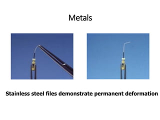 Metals
Stainless steel files demonstrate permanent deformation
 