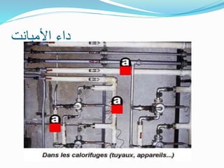 ‫األميانت‬ ‫داء‬
 