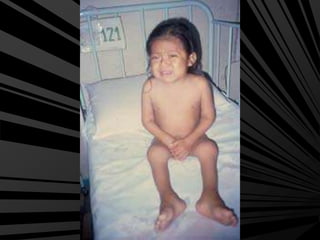 Artritis idiopatica juvenil