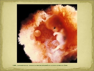 1 965. Le nnart nils s o n p u b lica la p rim e ra fo tografía d e u n fe to d e ntro d e l úte ro.
 