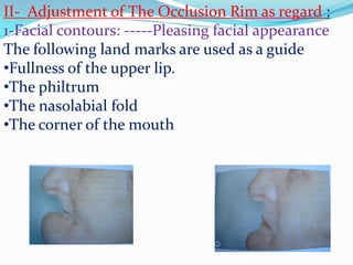 II- Adjustment of The Occlusion Rim as regard :
1-Facial contours: -----Pleasing facial appearance
The following land marks are used as a guide
•Fullness of the upper lip.
•The philtrum
•The nasolabial fold
•The corner of the mouth
 