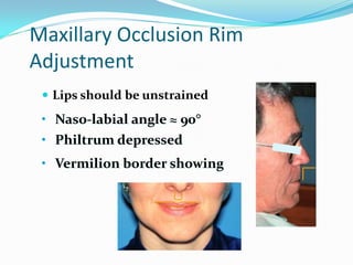 Maxillary Occlusion Rim
Adjustment
 Lips should be unstrained
• Naso-labial angle ≈ 90°
• Philtrum depressed
• Vermilion border showing
 