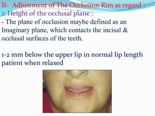 II- Adjustment of The Occlusion Rim as regard :
2-Height of the occlusal plane :
- The plane of occlusion maybe defined as an
Imaginary plane, which contacts the incisal &
occlusal surfaces of the teeth.
1-2 mm below the upper lip in normal lip length
patient when relaxed
 