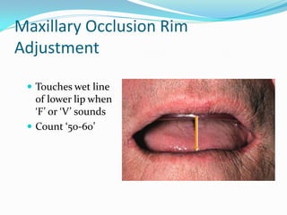 Maxillary Occlusion Rim
Adjustment
 Touches wet line
of lower lip when
‘F’ or ‘V’ sounds
 Count ‘50-60’
 