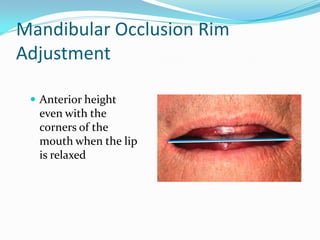 Mandibular Occlusion Rim
Adjustment
 Anterior height
even with the
corners of the
mouth when the lip
is relaxed
 