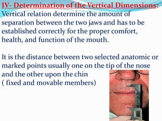 IV- Determination of the Vertical Dimensions:
Vertical relation determine the amount of
separation between the two jaws and has to be
established correctly for the proper comfort,
health, and function of the mouth.
It is the distance between two selected anatomic or
marked points usually one on the tip of the nose
and the other upon the chin
( fixed and movable members)
 