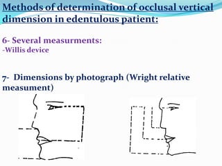 Methods of determination of occlusal vertical
dimension in edentulous patient:
6- Several measurments:
-Willis device
7- Dimensions by photograph (Wright relative
measument)
 