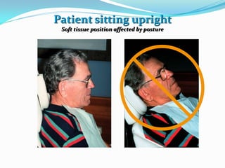 Patient sitting upright
Soft tissue position affected by posture
 