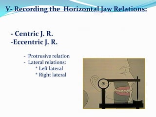 V- Recording the Horizontal Jaw Relations:
- Centric J. R.
-Eccentric J. R.
- Protrusive relation
- Lateral relations:
* Left lateral
* Right lateral
 