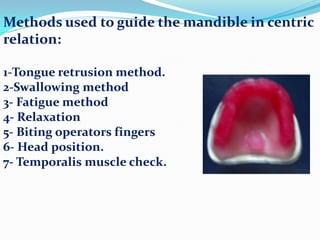 Methods used to guide the mandible in centric
relation:
1-Tongue retrusion method.
2-Swallowing method
3- Fatigue method
4- Relaxation
5- Biting operators fingers
6- Head position.
7- Temporalis muscle check.
 