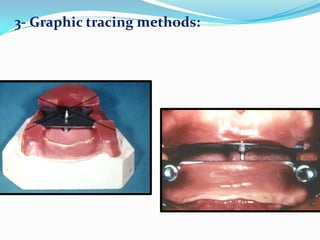 3- Graphic tracing methods:
 