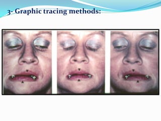 3- Graphic tracing methods:
 