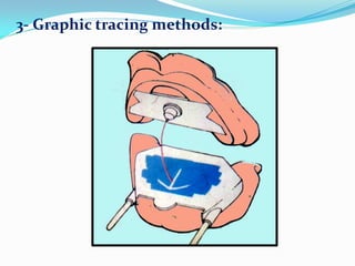 3- Graphic tracing methods:
 