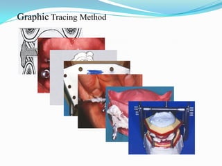 Graphic Tracing Method
 