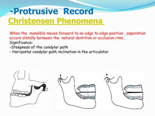 Christensen Phenomena
When the mandible moves forward to an edge to edge position , separation
occurs distally between the natural dentition or occlusion rims .
Significance:
-Steepness of the condylar path
- Horizontal condylar path inclination in the articulator
-Protrusive Record
 