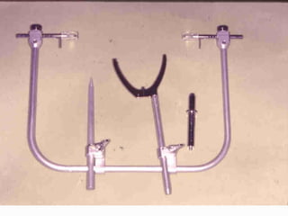 4 &amp; 5 jaw relation 1 &amp; 2