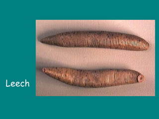 Leech
 