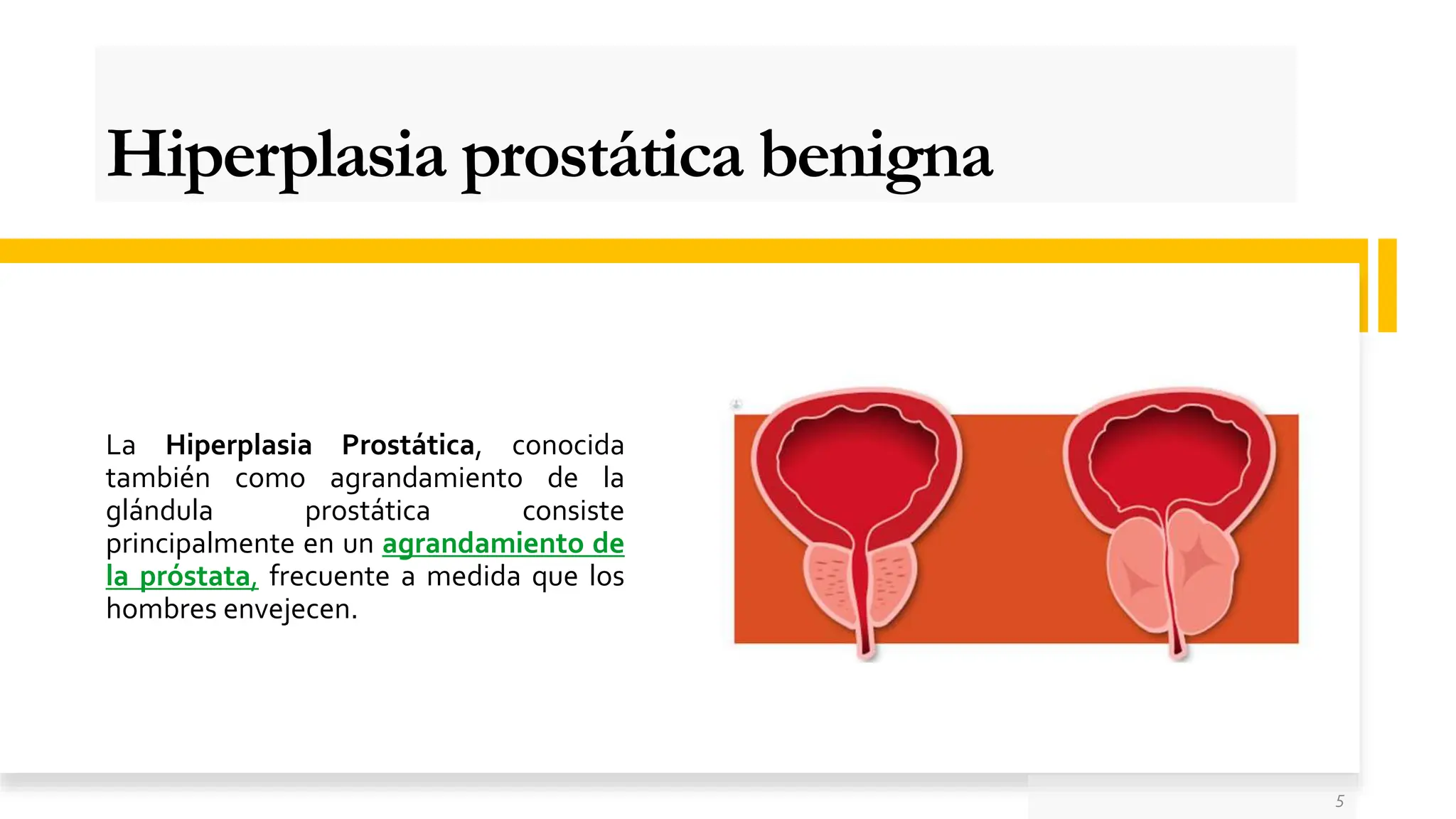 Hiperplasia prostática benigna adulto hombre | PPT