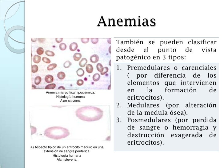 46. sangre, linfa y hematopoyesis