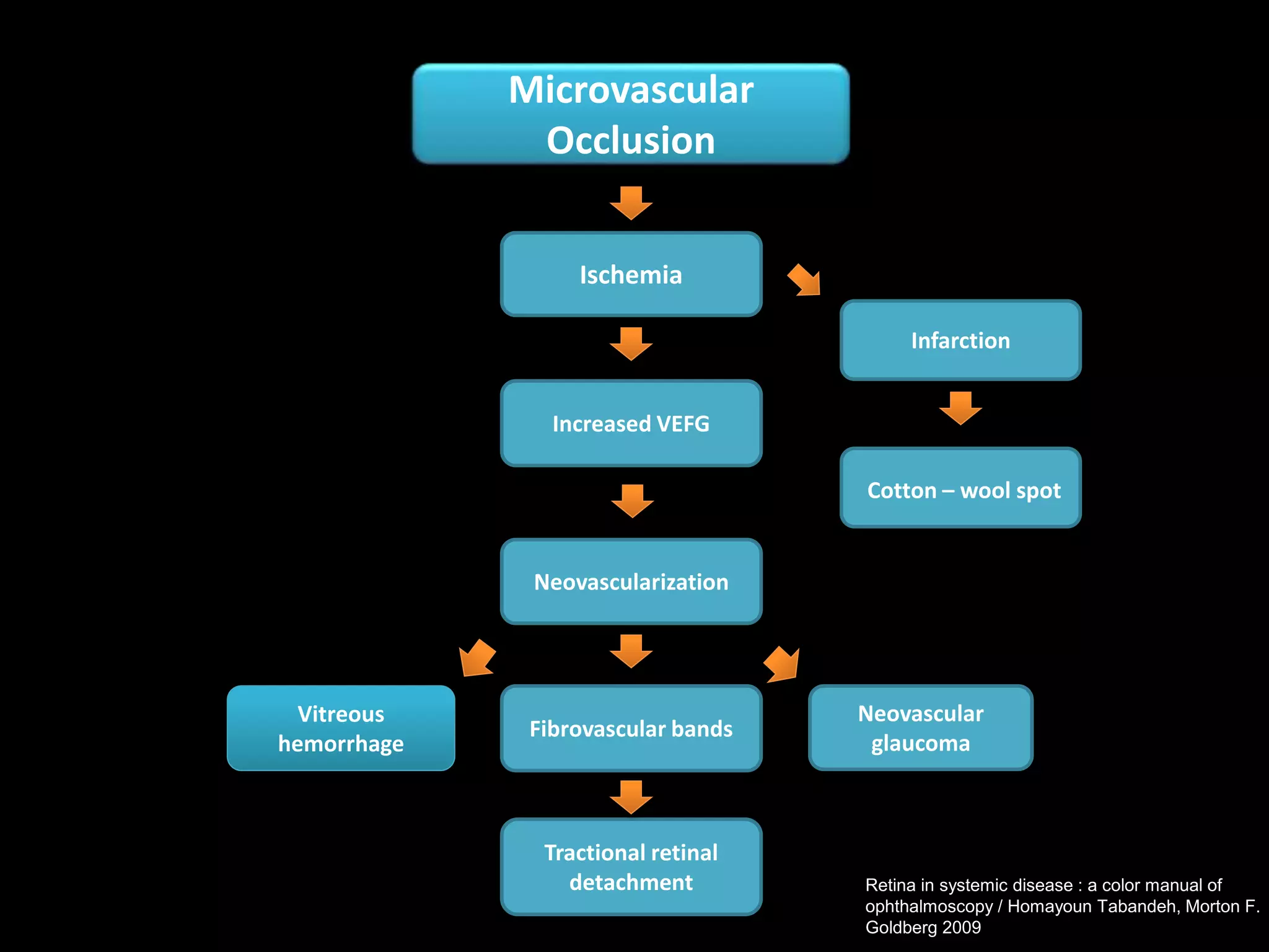 Cotton – wool spot
Neovascularization
Ischemia
Neovascular
glaucoma
Microvascular
Occlusion
Fibrovascular bands
Vitreous
hemorrhage
Increased VEFG
Tractional retinal
detachment Retina in systemic disease : a color manual of
ophthalmoscopy / Homayoun Tabandeh, Morton F.
Goldberg 2009
Infarction
 