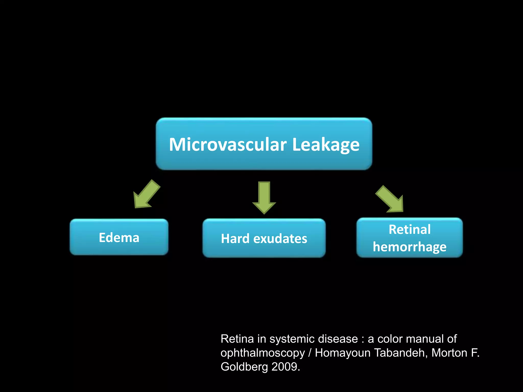 Edema
Retinal
hemorrhage
Hard exudates
Microvascular Leakage
Retina in systemic disease : a color manual of
ophthalmoscopy / Homayoun Tabandeh, Morton F.
Goldberg 2009.
 