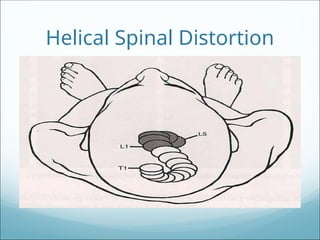 462921452-Postural analize fisioterapi y | PPT