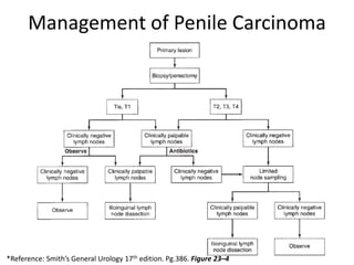 Management of Penile Carcinoma
*Reference: Smith’s General Urology 17th edition. Pg.386. Figure 23–4
 