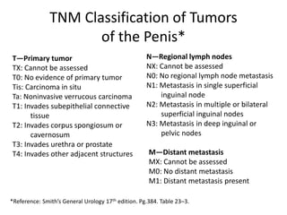 TNM Classification of Tumors
of the Penis*
T—Primary tumor
TX: Cannot be assessed
T0: No evidence of primary tumor
Tis: Carcinoma in situ
Ta: Noninvasive verrucous carcinoma
T1: Invades subepithelial connective
tissue
T2: Invades corpus spongiosum or
cavernosum
T3: Invades urethra or prostate
T4: Invades other adjacent structures
N—Regional lymph nodes
NX: Cannot be assessed
N0: No regional lymph node metastasis
N1: Metastasis in single superficial
inguinal node
N2: Metastasis in multiple or bilateral
superficial inguinal nodes
N3: Metastasis in deep inguinal or
pelvic nodes
M—Distant metastasis
MX: Cannot be assessed
M0: No distant metastasis
M1: Distant metastasis present
*Reference: Smith’s General Urology 17th edition. Pg.384. Table 23–3.
 