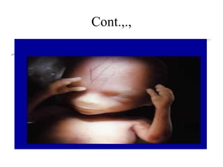 466416256-Stages-of-fetal-development-Final-PPT.pptx