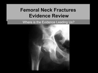 Femoral Neck Fractures
Evidence Review
Where is the Evidence Leading Us?
 