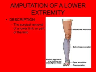 AMPUTATION OF A LOWER
EXTREMITY
• DESCRIPTION
– The surgical removal
of a lower limb or part
of the limb
 
