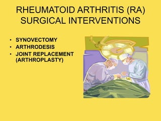 RHEUMATOID ARTHRITIS (RA)
SURGICAL INTERVENTIONS
• SYNOVECTOMY
• ARTHRODESIS
• JOINT REPLACEMENT
(ARTHROPLASTY)
 