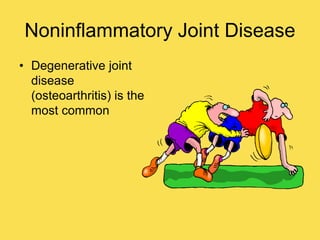 Noninflammatory Joint Disease
• Degenerative joint
disease
(osteoarthritis) is the
most common
 