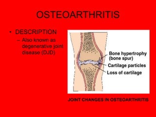 OSTEOARTHRITIS
• DESCRIPTION
– Also known as
degenerative joint
disease (DJD)
JOINT CHANGES IN OSTEOARTHRITIS
 