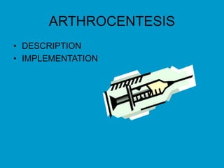 ARTHROCENTESIS
• DESCRIPTION
• IMPLEMENTATION
 