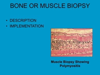 BONE OR MUSCLE BIOPSY
• DESCRIPTION
• IMPLEMENTATION
Muscle Biopsy Showing
Polymyositis
 