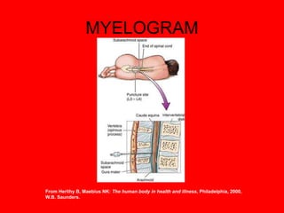MYELOGRAM
From Herlihy B, Maebius NK: The human body in health and illness, Philadelphia, 2000,
W.B. Saunders.
 