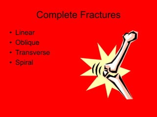 Complete Fractures
• Linear
• Oblique
• Transverse
• Spiral
 