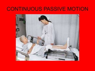 CONTINUOUS PASSIVE MOTION
 
