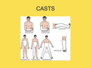 CASTS
 