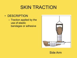 SKIN TRACTION
• DESCRIPTION
– Traction applied by the
use of elastic
bandages or adhesive
Side Arm
 
