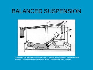 BALANCED SUSPENSION
From Black JM, Matassarin-Jacobs E (1993) Luckman and Sorensen’s medical-surgical
nursing: a psychophysiologic approach, 4th ed., Philadelphia: W.B. Saunders.
 