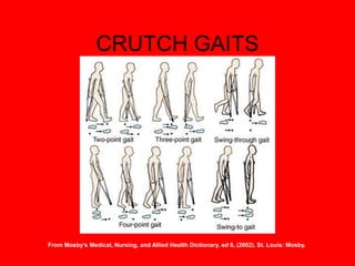CRUTCH GAITS
From Mosby’s Medical, Nursing, and Allied Health Dictionary, ed 6, (2002). St. Louis: Mosby.
 