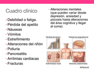 Cuadro clínico
• Debilidad o fatiga.

• Pérdida del apetito
• Náuseas
• Vómitos
• Estreñimiento
• Alteraciones del riñón
• Poliuria
• Pancreatitis

• Arritmias cardíacas
• Fracturas

• Alteraciones mentales

(que pueden variar desde
depresión, ansiedad y
psicosis hasta alteraciones
del área cognitiva y llegar
al coma)

 